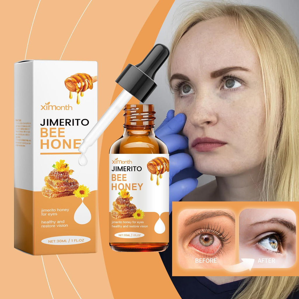 Ximengsijimeito Eye Honey Refreshing Moisturizing Soothing Dry Eyes Eye Drops