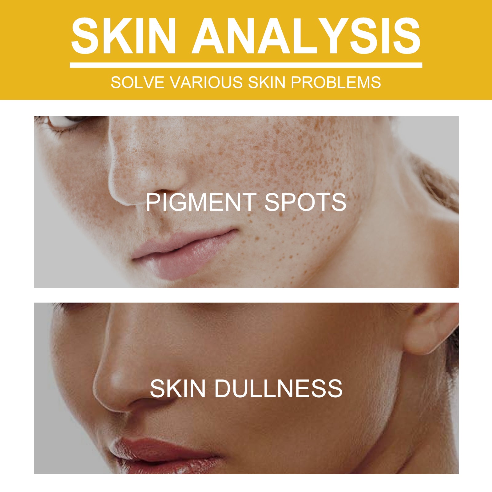 Wiyun V7 Whitening Cream Reduces Wrinkles And Fine Lines On The Face, Moisturizes And Brightens Skin, Anti-Aging And Replenishing Cream