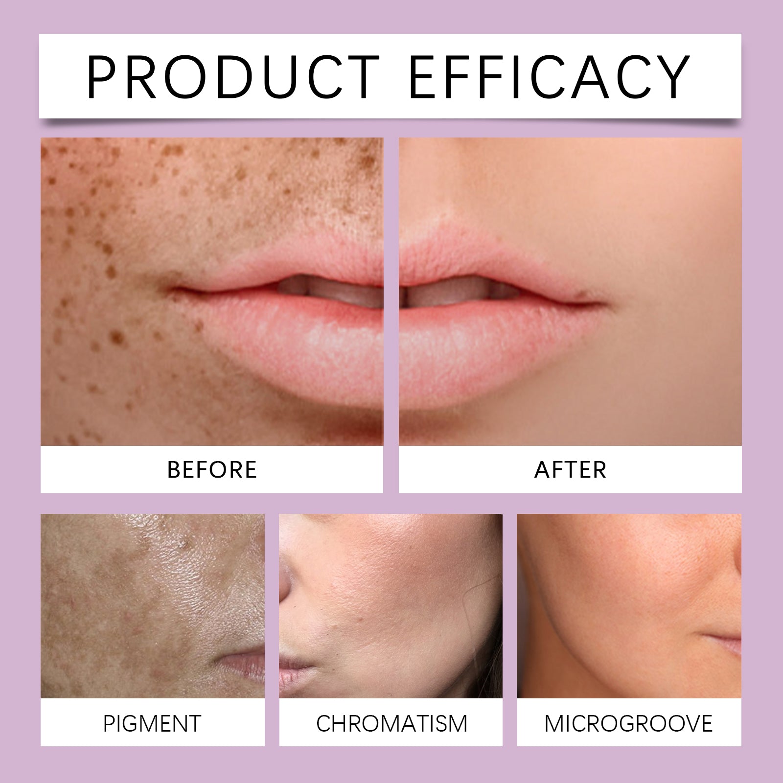 Hoygi Tone Balancing Essence, Desalination Moisturizing Facial Spots Moist Shine Bright Skin Essence