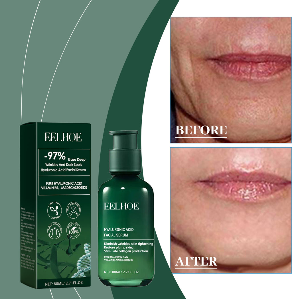 EELHOE Facial Moisturizing Essence Skin Moisturizing, Hydrating, Moisturizing Light Line And Gloss Skin Care Essence