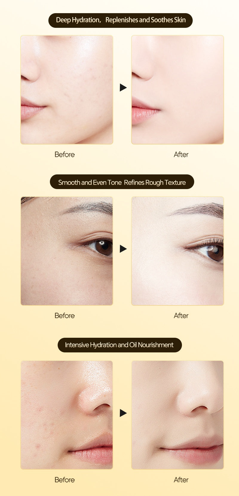 Essence Oil, Double Anti-repair, Nourishing, Moisturizing, Firming, Anti-wrinkle And Hydrating Essence