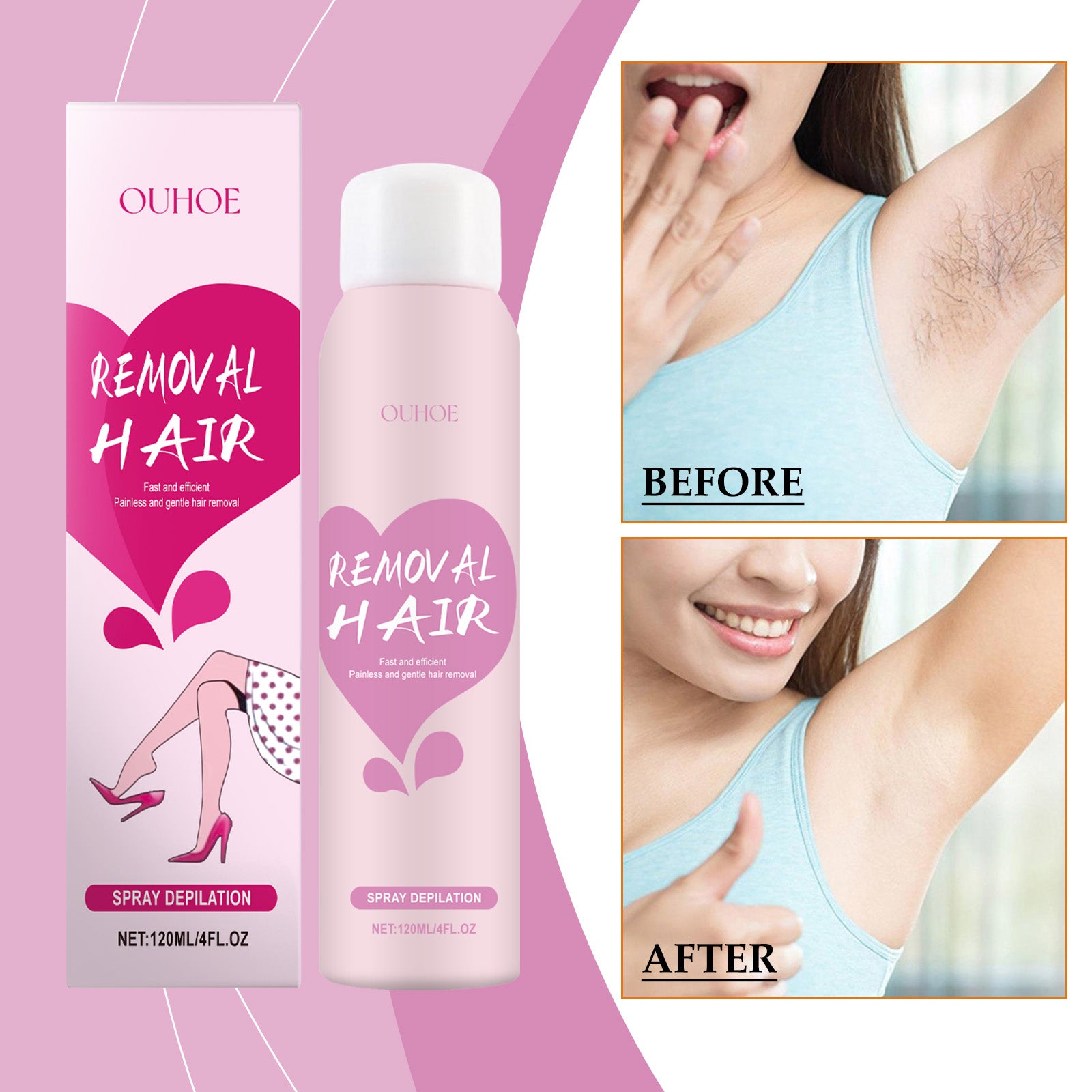 OUHOE Mousse Body Hair Removal Spray, All Over The Body Armpits, Hands, Legs Smooth And Delicate Skin Gentle Hair Removal
