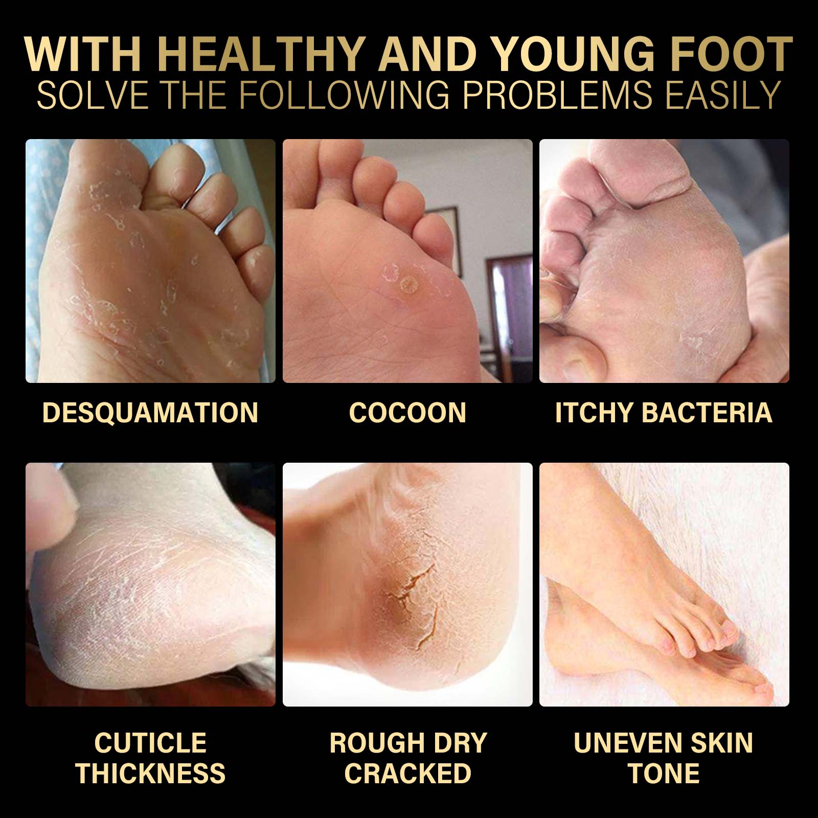 Jaysuing Lavender Exfoliating Foot Mask Exfoliating Foot Care Hydrating, Hydrating, Anti-chapping And Moisturizing Skin