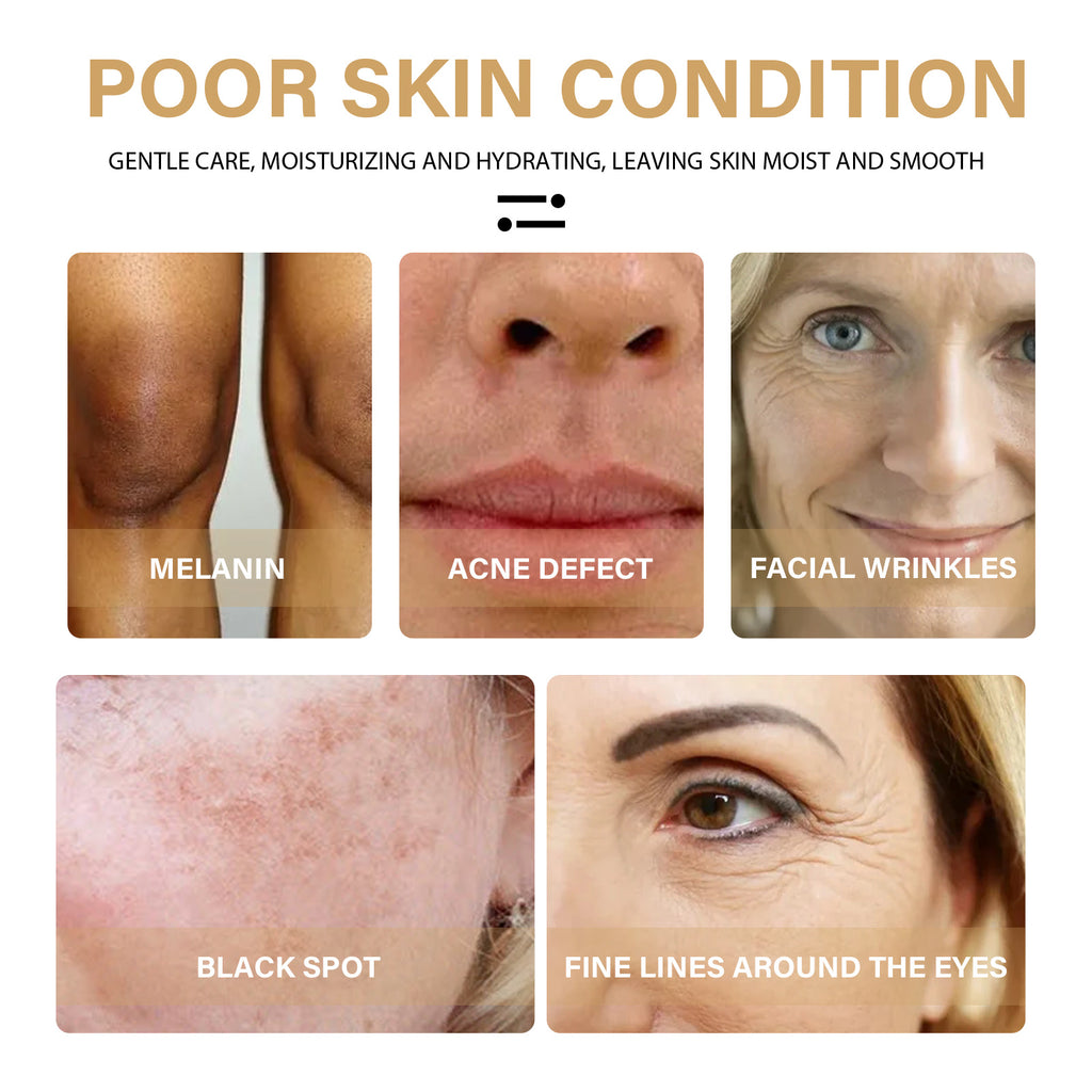 EELHOE Turmeric Dark Spot Correction Face Care Spot Moisturizing And Repairing Skin Tone Serum