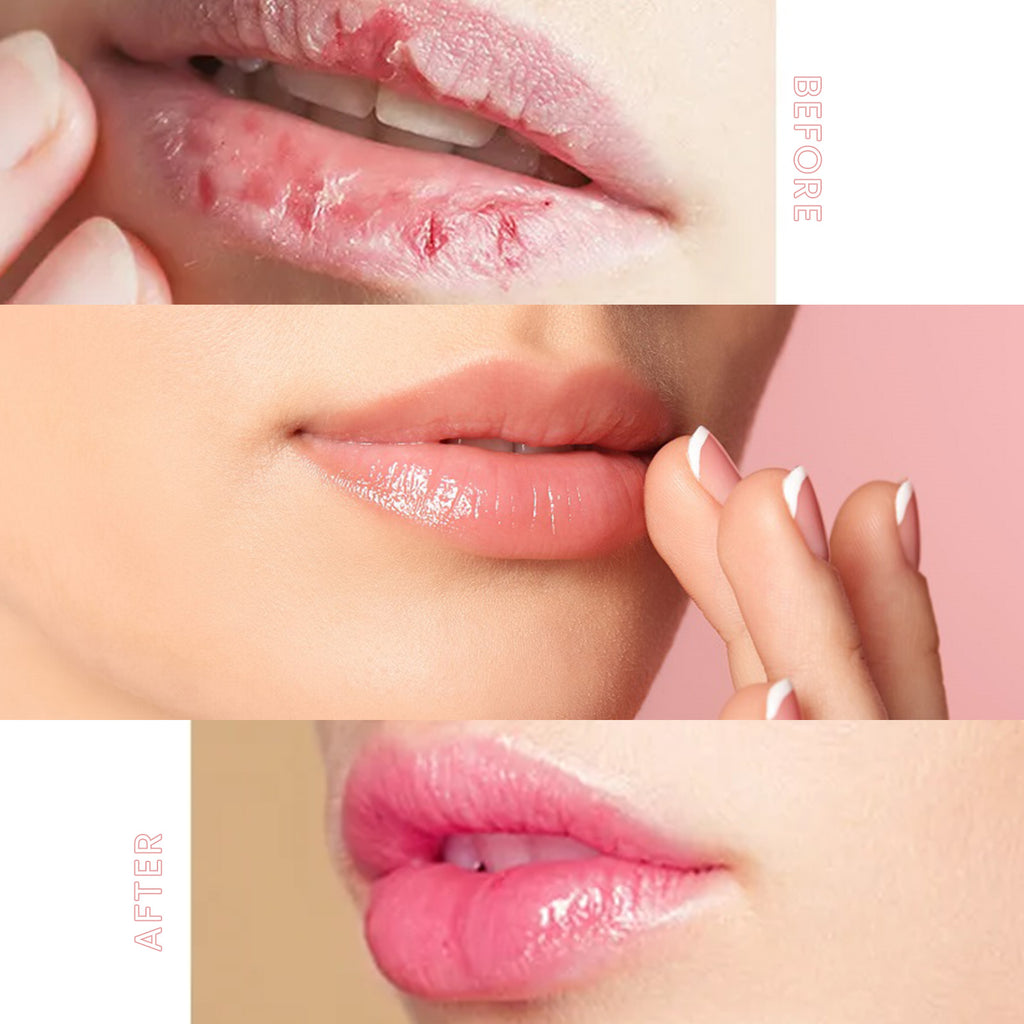 Moisturizing And Plump Lip Mask