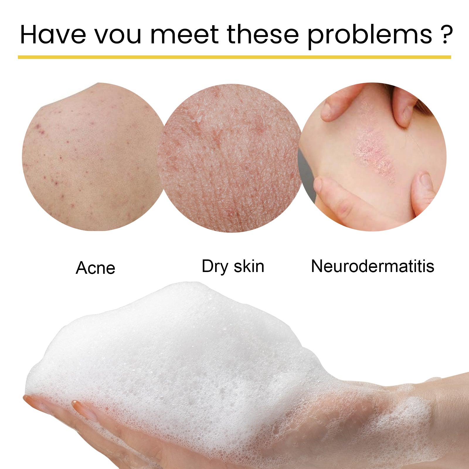 EELHOE Propolis Soap, Deep Cleansing Body Skin Lighten Pimples Tender Smooth Skin Propolis Bath Soap