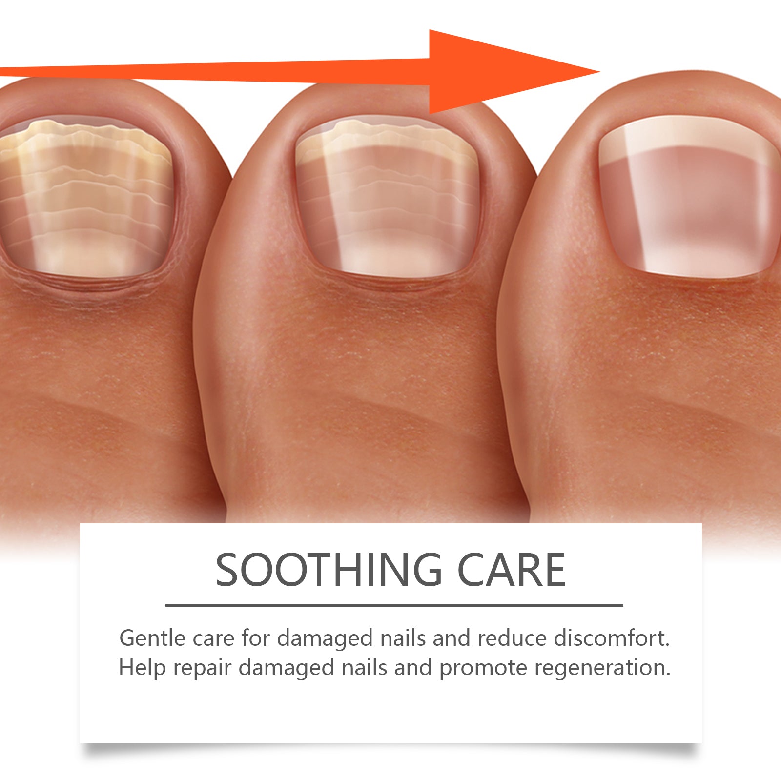 Ximonth Herbal Nail Care Solution Hand, Foot And Nail Cleansing And Repair Bright Nail Thick Toe Care Solution