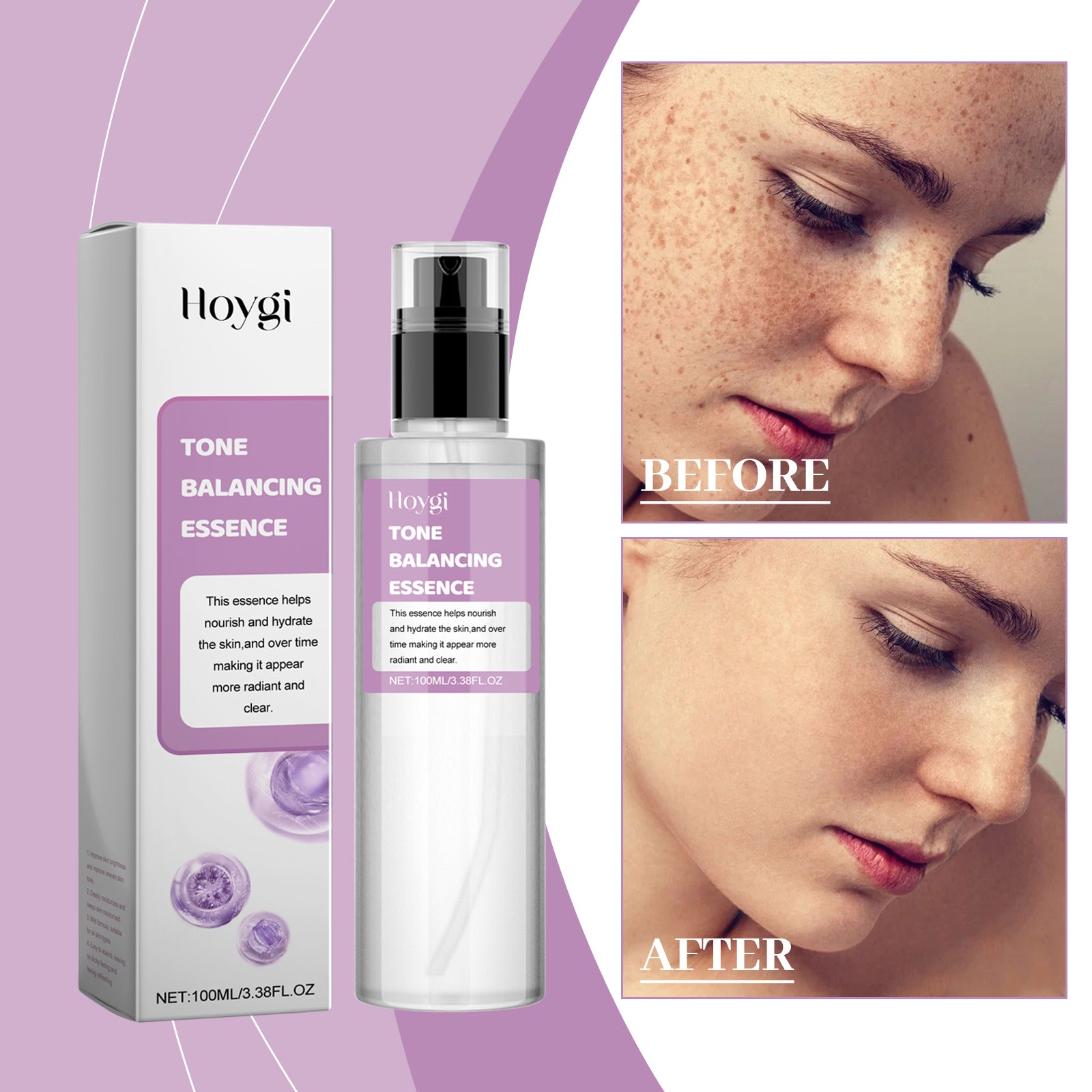 Hoygi Tone Balancing Essence, Desalination Moisturizing Facial Spots Moist Shine Bright Skin Essence
