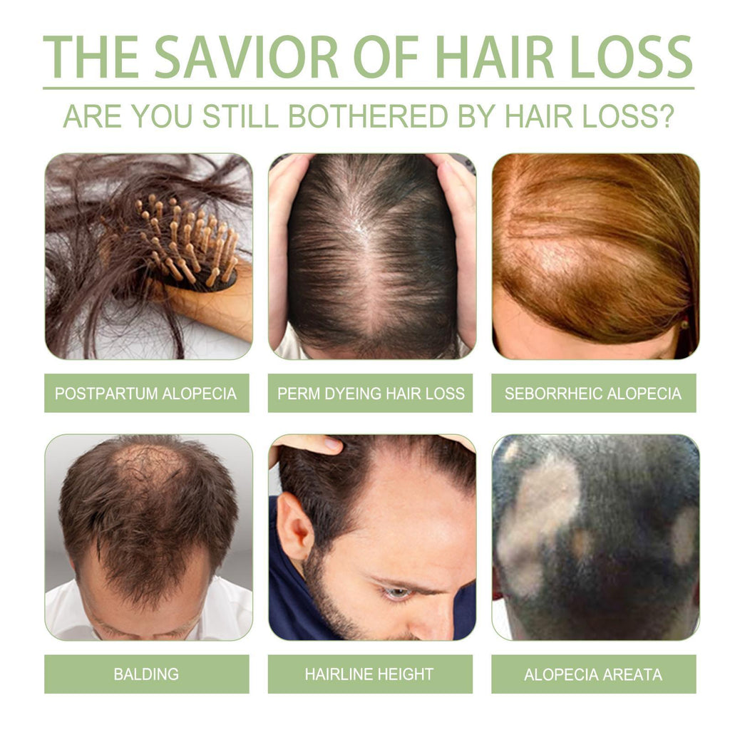 Ohoy Herbal Hair Oil Gently Nourishes The Scalp, Strengthens Hair, Cleanses The Scalp And Softens Hair