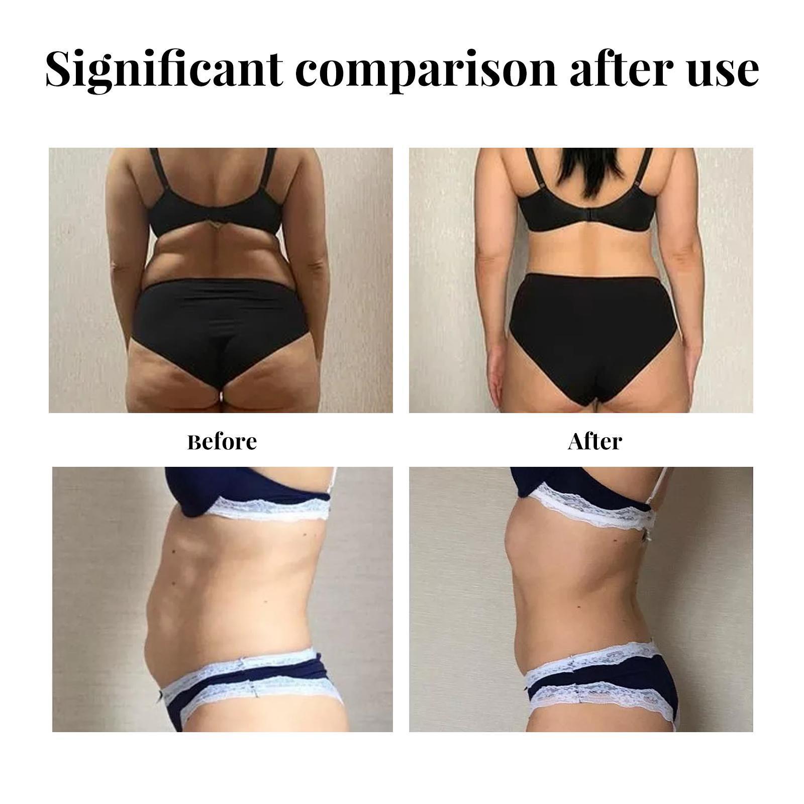 Yihe Abdomen Lifting Belt, Tightens Loose Skin And Reshapes Belly Button