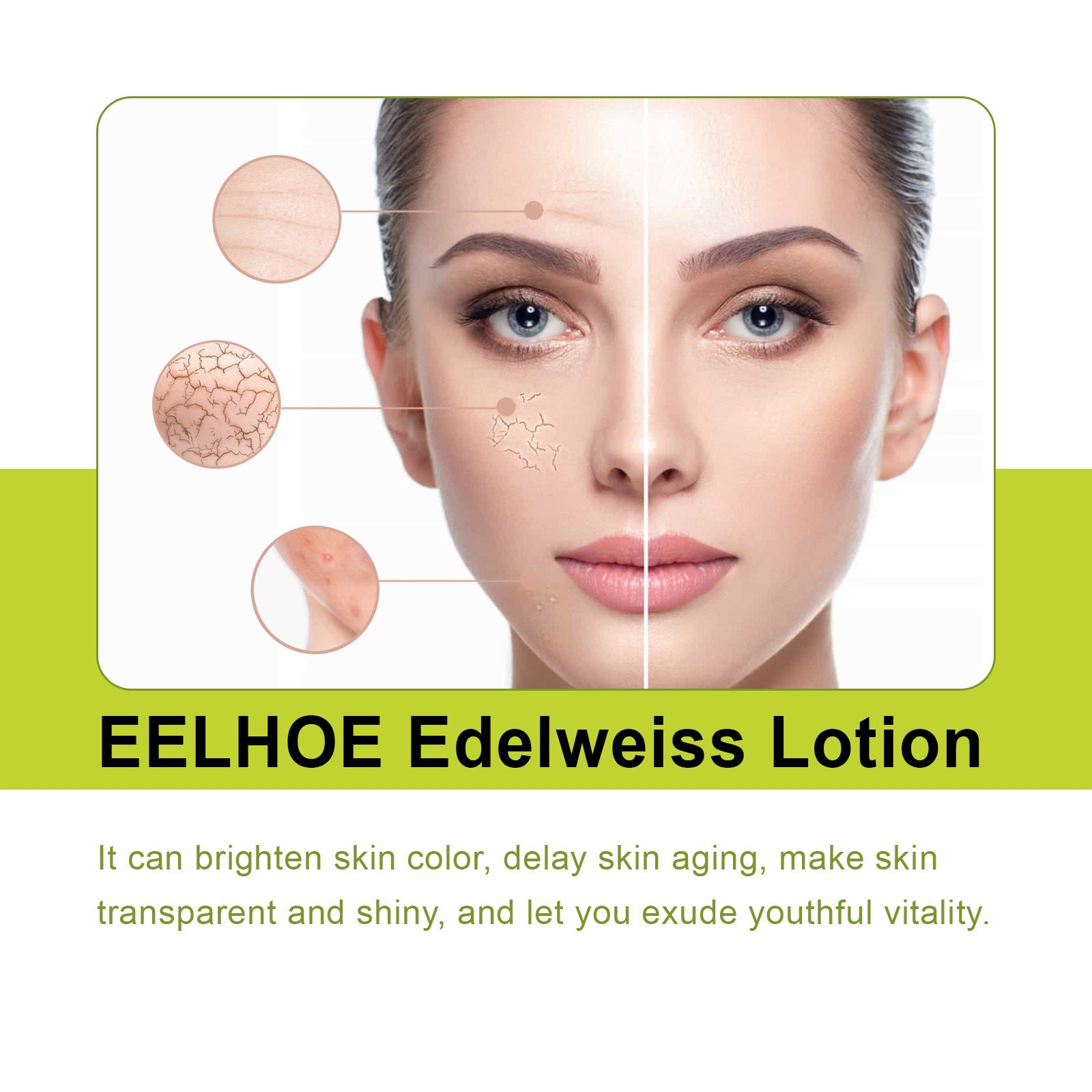 EELHOE Edelweiss Lotion, Moisturizing And Brightening Face Dull And Shiny Skin Moisturizing Lotion